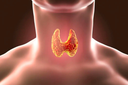 tumor SETTLE