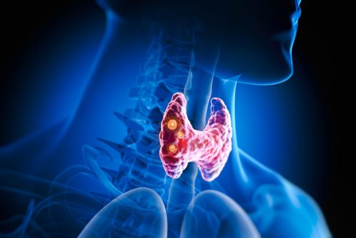 cancer-laringe-e-faringe